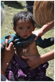 Erste Hilfe Zentrum Nepal